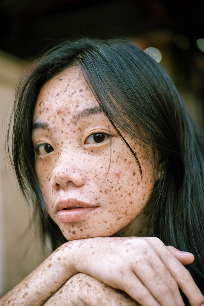 A close up photography of woman's face with freckles